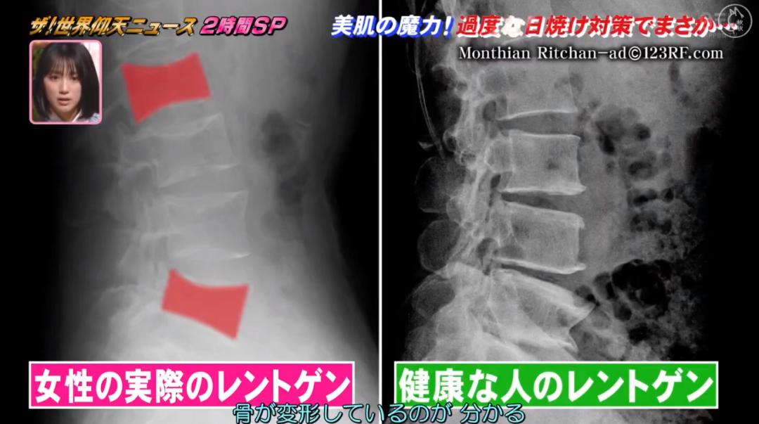 日本漂亮小姐姐不想被晒黑，每天全副武装！2年后身高竟缩水7cm…