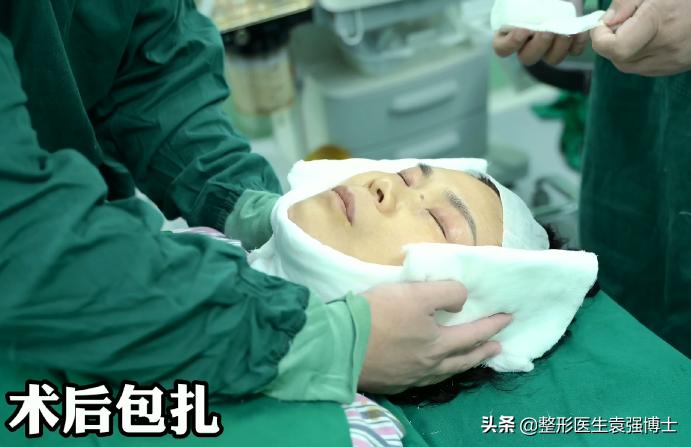 50岁后拉皮手术三天的样子,58岁做拉皮手术重返20岁