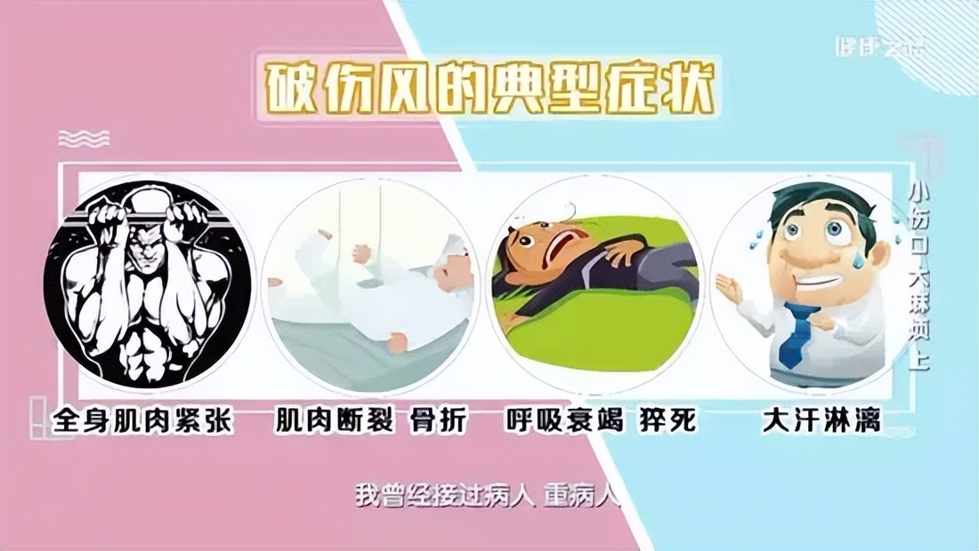 儿童钉刺伤需打破伤风疫苗吗,豫健科普介绍