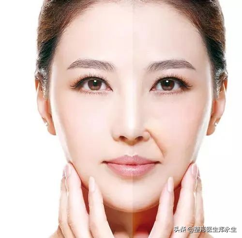 轻松去除面部皱纹的最有效方法,男士面部皱纹去除妙招