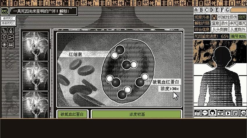 如何从尸体判断死亡原因,判断尸体死亡的六种可能