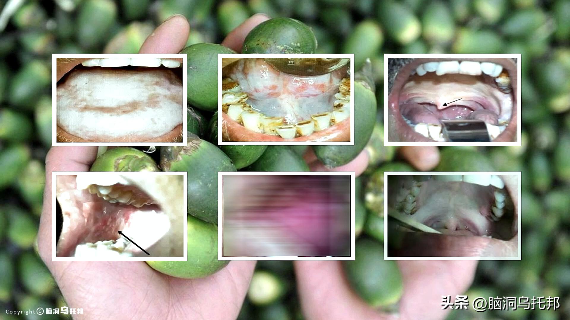 一级致癌物被包装成网红零食,一级致癌物槟榔长期热销