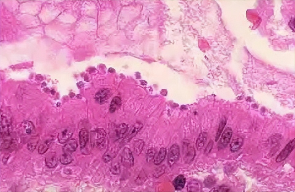 泳池的水有多脏,游泳怎么样可以防止下体进水感染