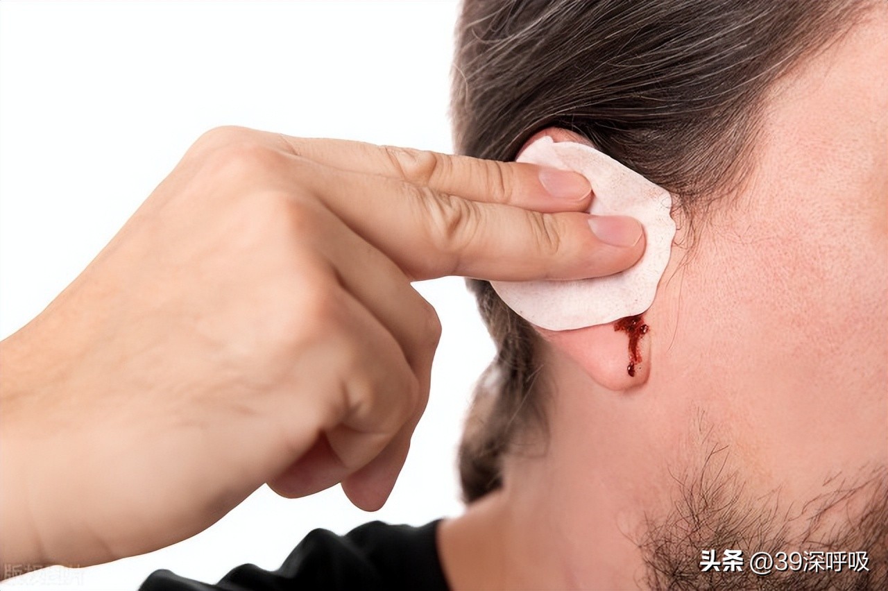 被扇嘴巴导致耳聋了,被人打了一巴掌导致神经性耳聋