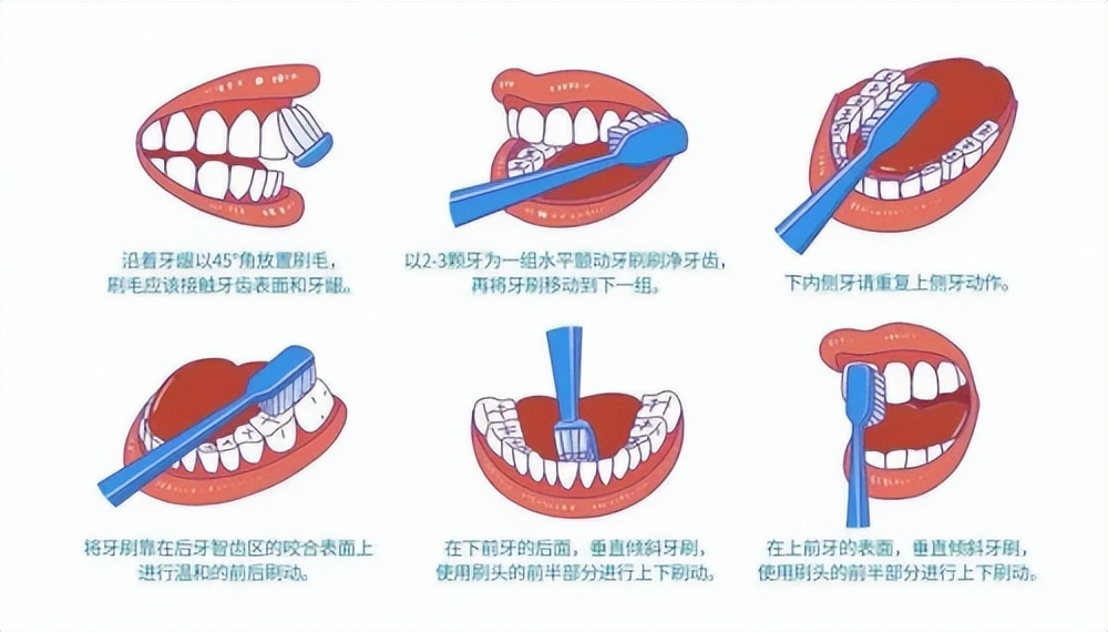如何推荐一款电动牙刷品牌,u型电动牙刷哪个牌子好一点耐用