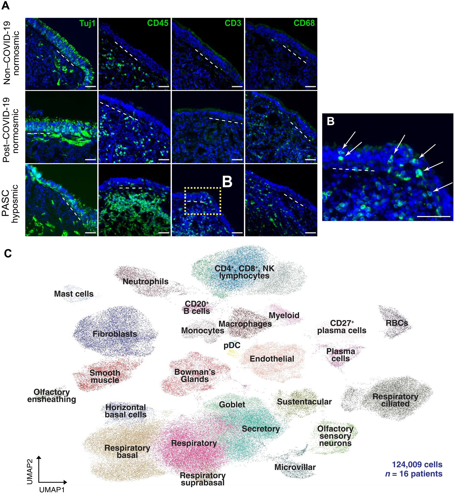 新冠后失去嗅觉,新冠之后失去嗅觉了怎么办