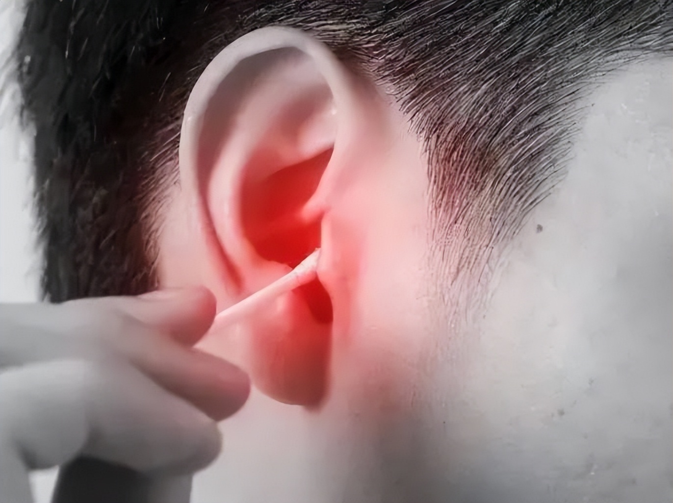 耳朵溃脓发痒可以掏耳朵吗,耳朵里面奇痒无比怎么回事