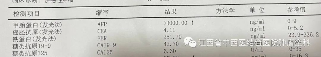 肝癌多发性肝内转移靶向药,肝癌中晚期免疫靶向有奇迹出现吗