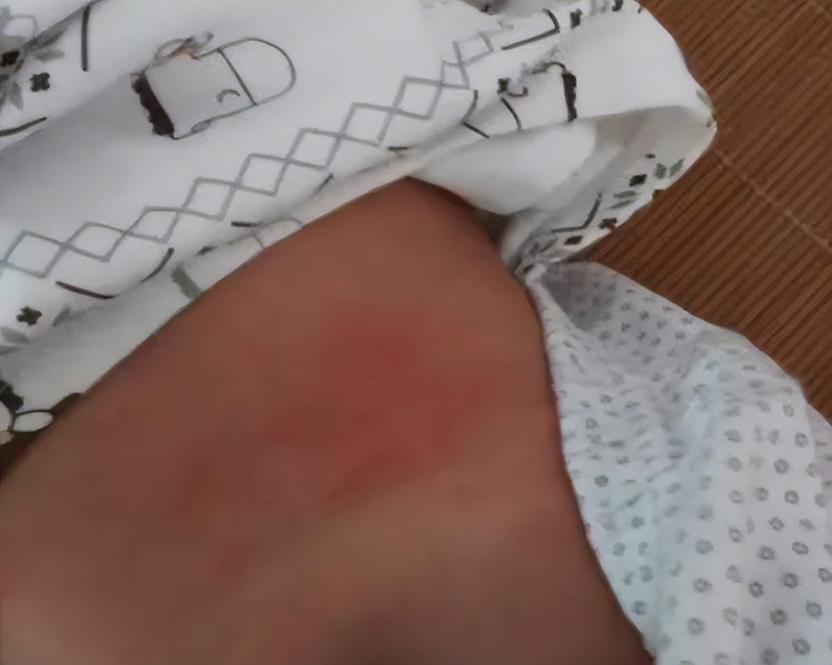 胃火肺火的症状有哪些,胃火旺和肺火旺的症状