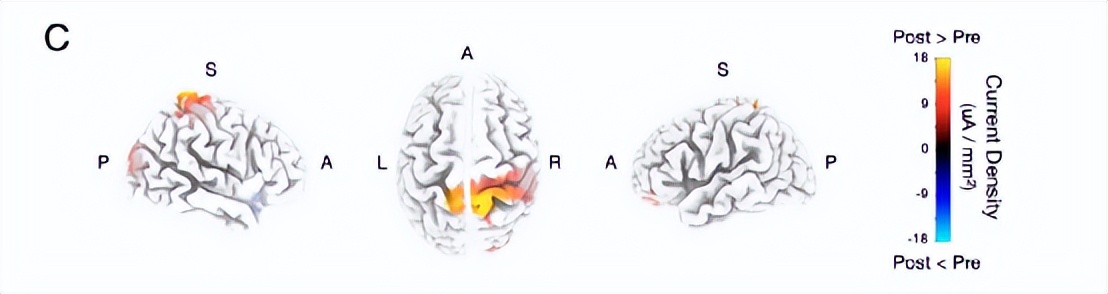 防止老年痴呆益智游戏推荐免费,防痴呆的手指游戏