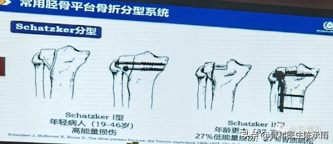 国家卫健委主办的骨创伤专项能力培训项目----下肢损伤学习班