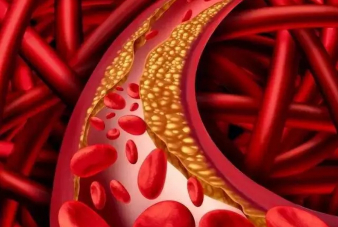 心血管疾病的药要一直吃吗,心血管病患者长期吃药有什么伤害