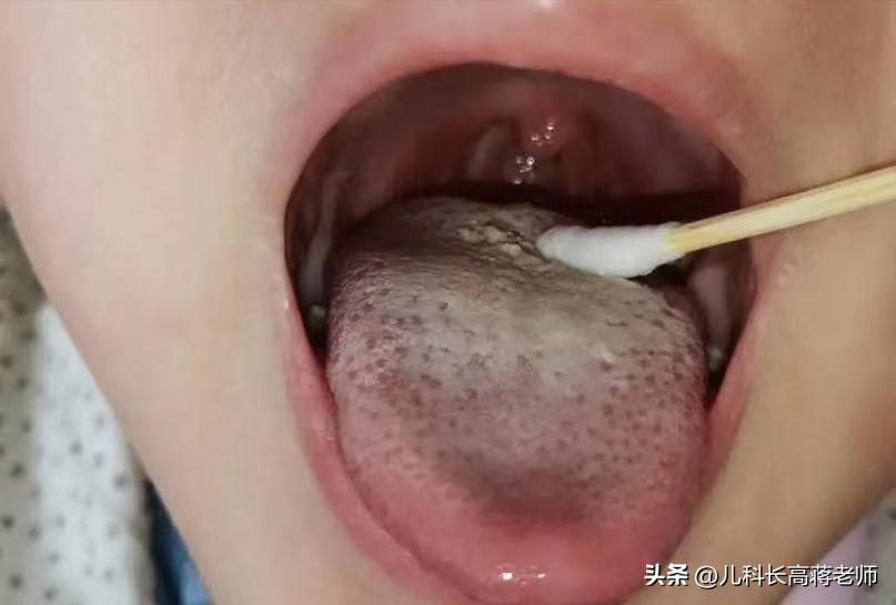 孩子不长个特别瘦是怎么回事,孩子不长个不长肉如何食疗