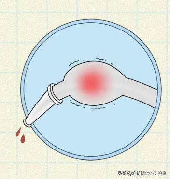 排便过于用力会导致出血吗,排便时太过用力导致疼痛