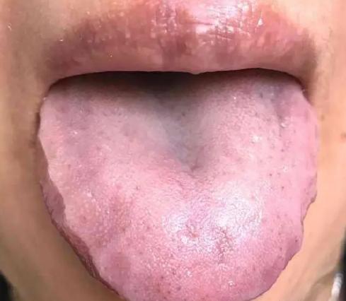 肺肝肾心脾虚怎么调理,脾肺气虚的最简单调理方法