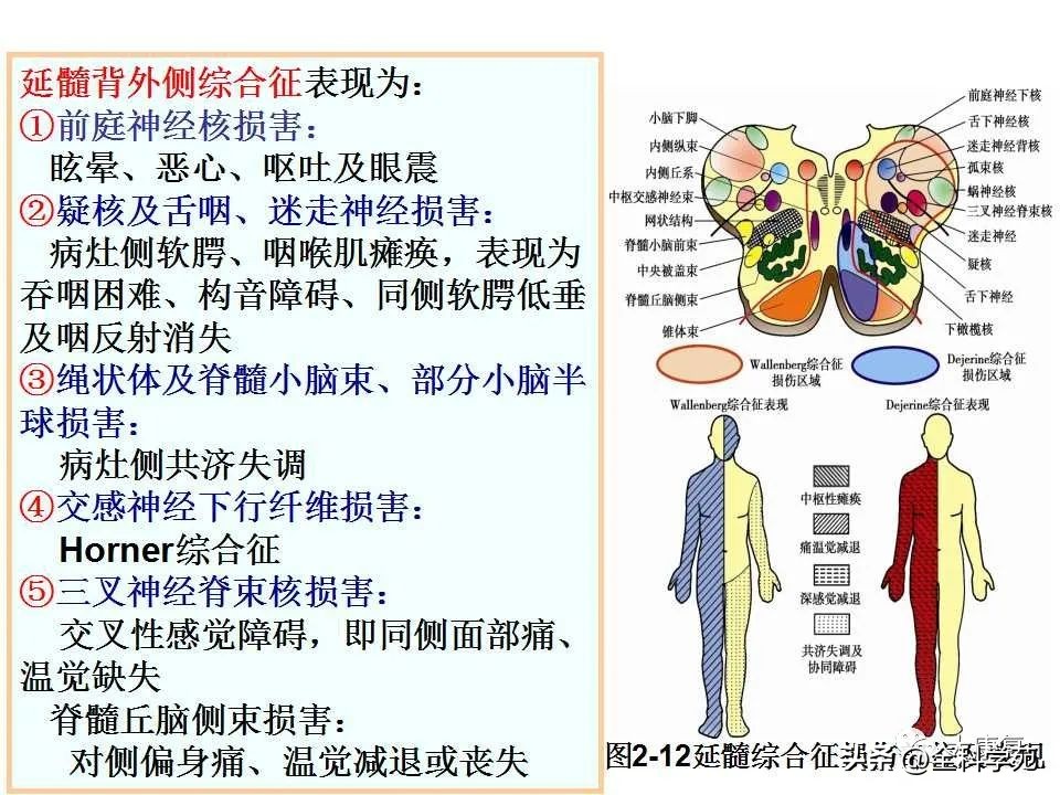 神经系统的影像与解剖定位,最全神经解剖图