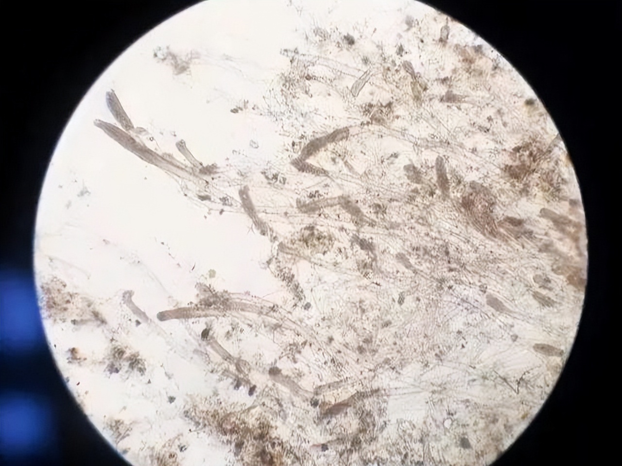 淡水鱼长白毛怎么治,鱼身上长白毛是什么病怎么防治