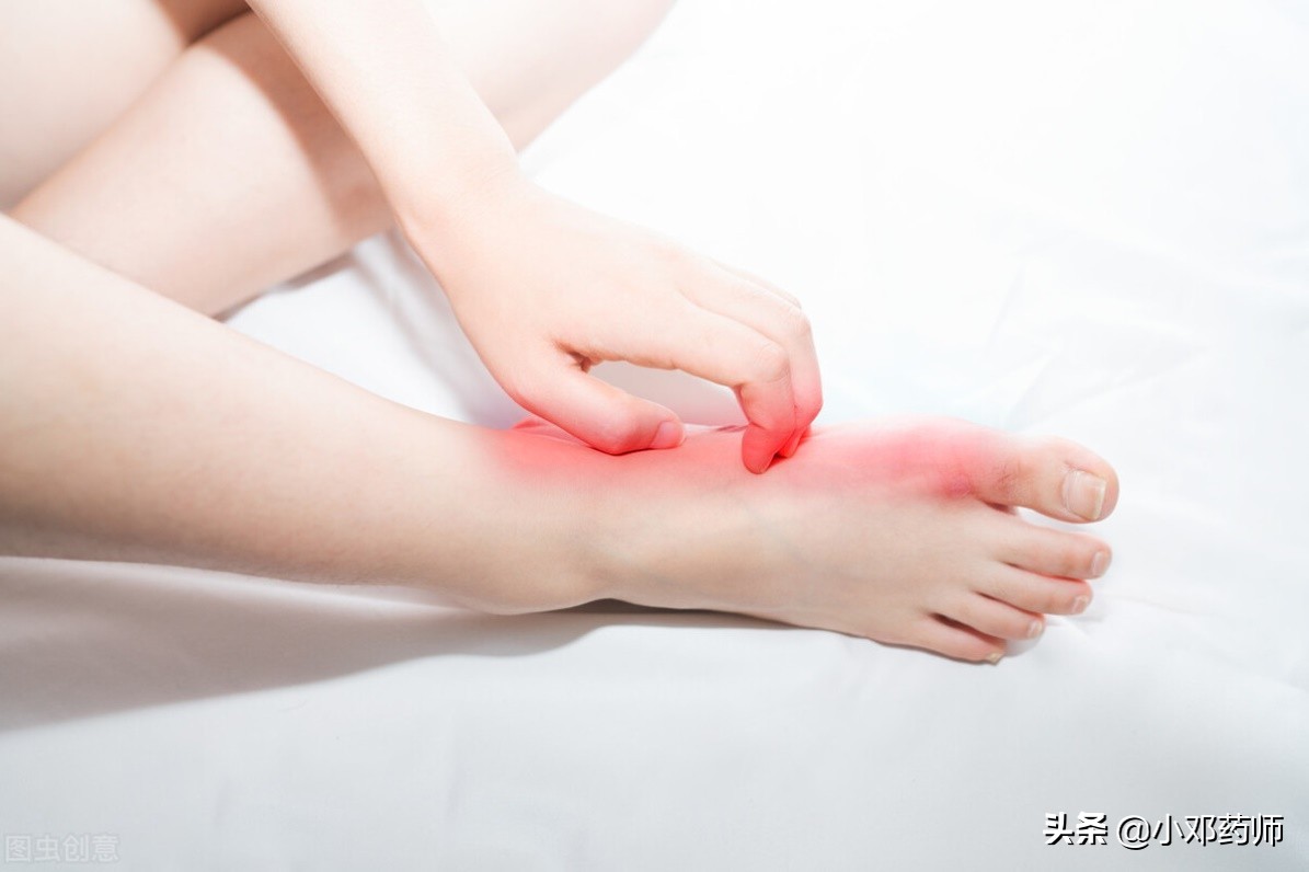 脚癣指甲特别硬怎么治,水泡型脚癣进到指甲里面怎么治疗