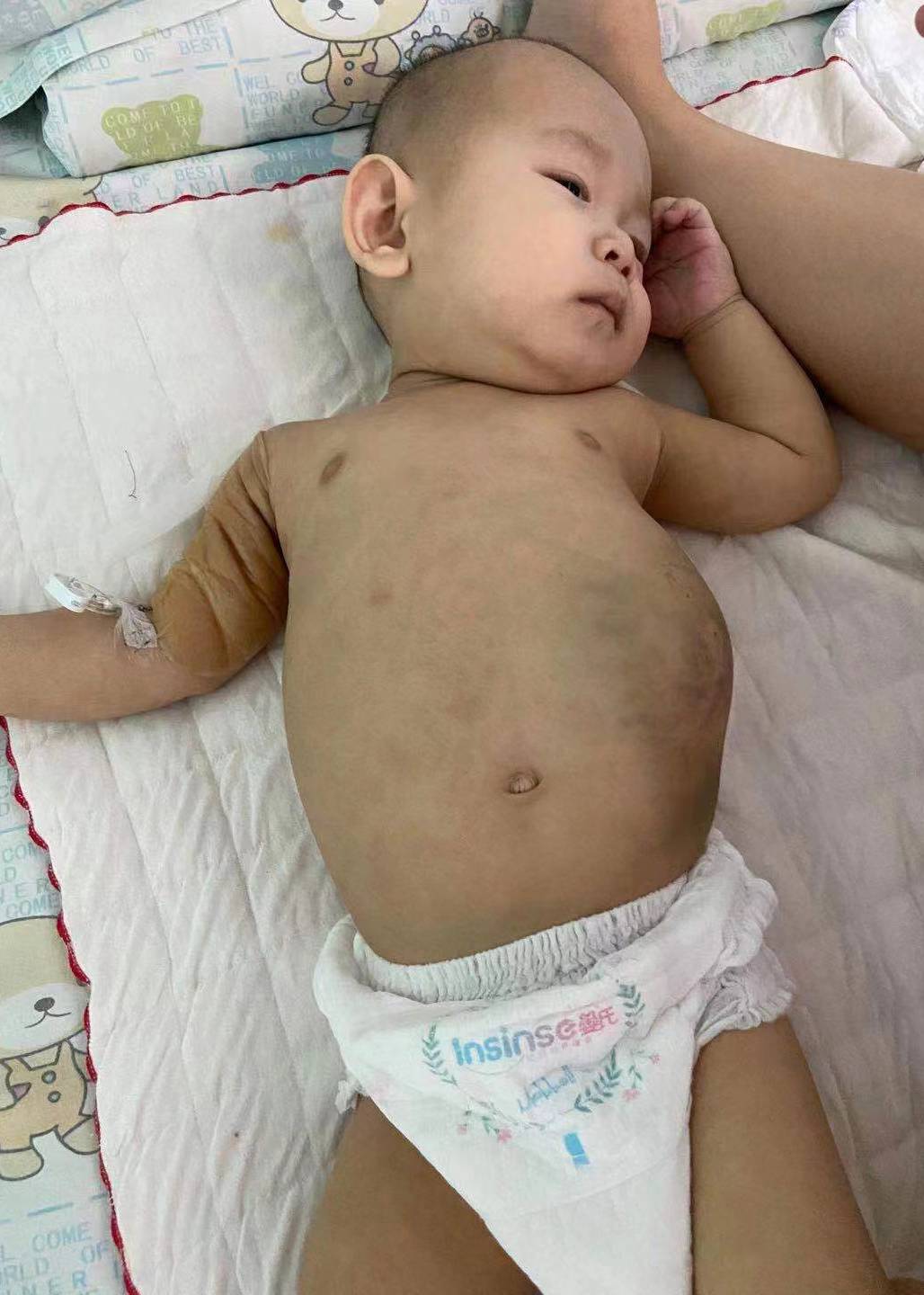 婴儿患癌离世,刚出生的婴儿患癌