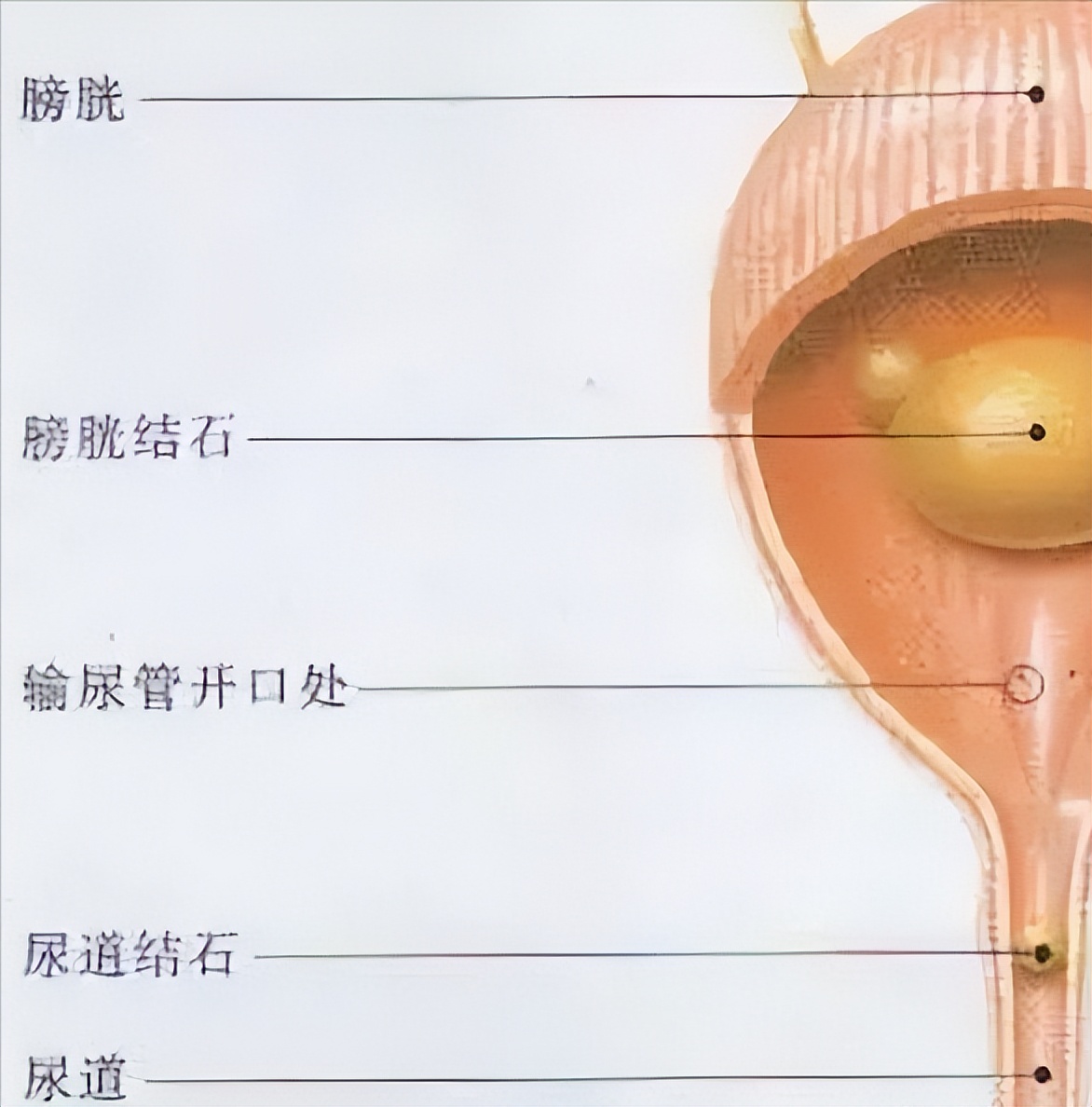 狗狗泌尿结石吃什么药好,狗狗尿路结石保守治疗