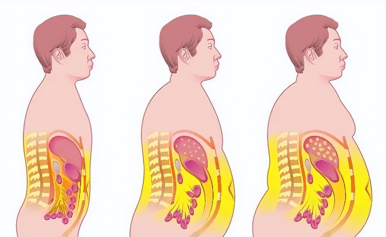 为什么到了30岁以后特别容易发胖,为什么有些人越来越容易发胖