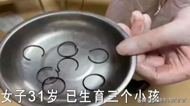 荒唐的故事，3宝妈将弹簧塞入体内避孕...