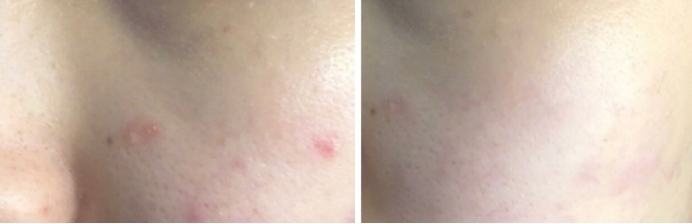 孕妇专用护肤品有哪些比较好的,孕期护肤品推荐孕妇用哪款