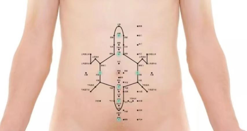 腹针疗法,腹针疗法最新处方大全