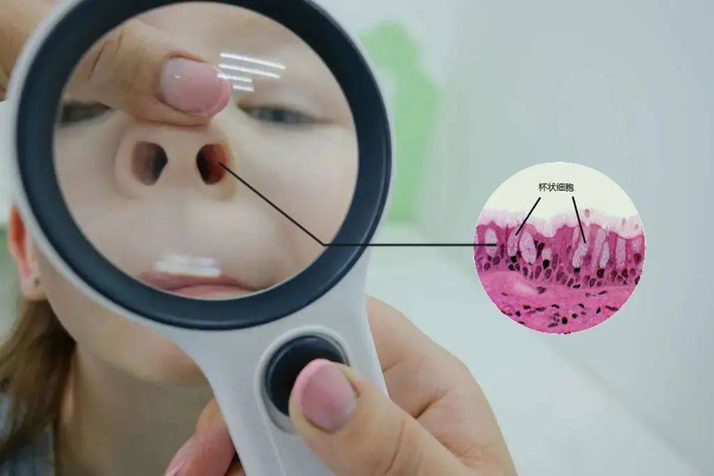 感冒黄绿色鼻涕是什么原因,感冒黄绿色浓稠鼻涕吃什么药