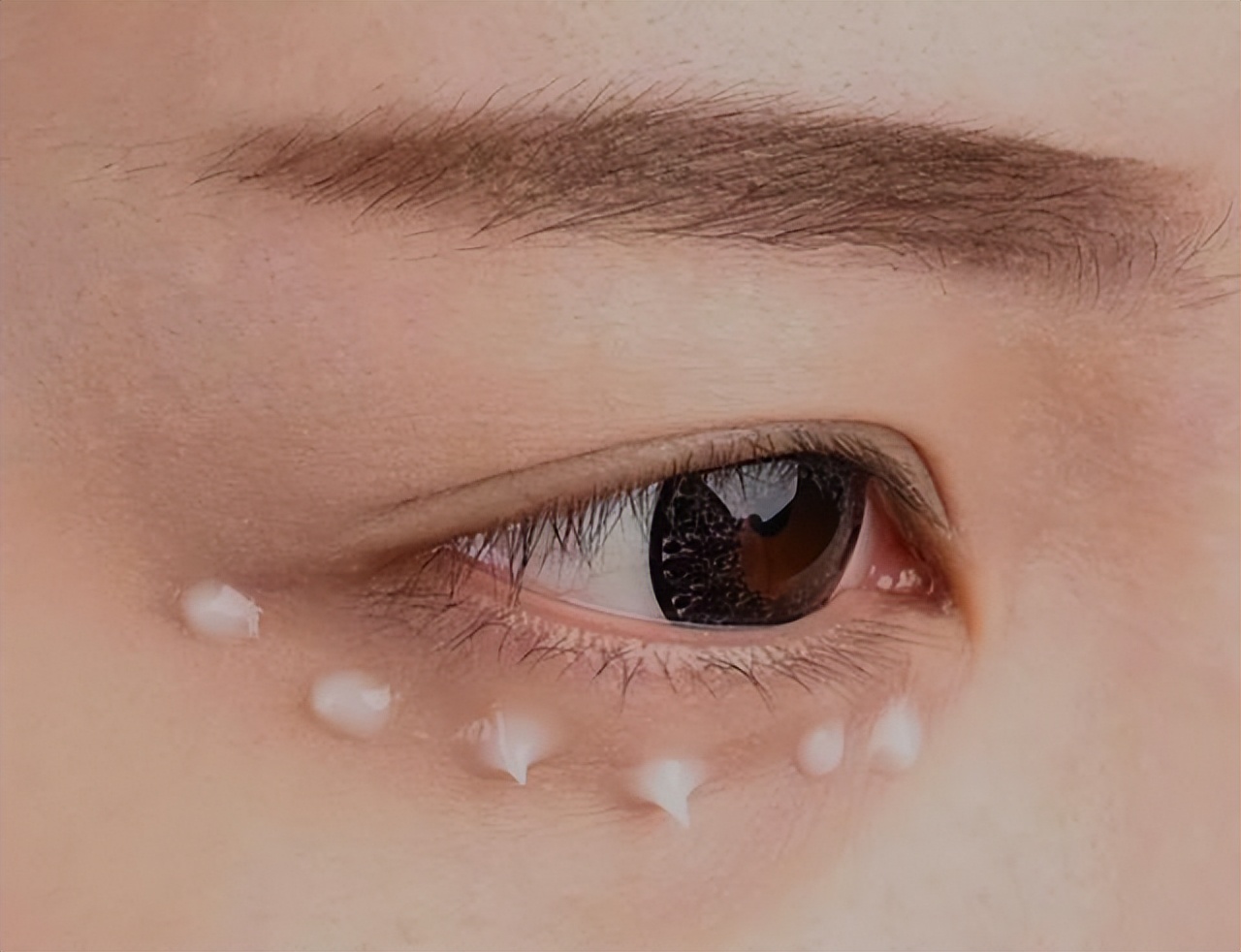 红霉素软膏抹脸上会变白吗,红霉素软膏可以擦眼下吗