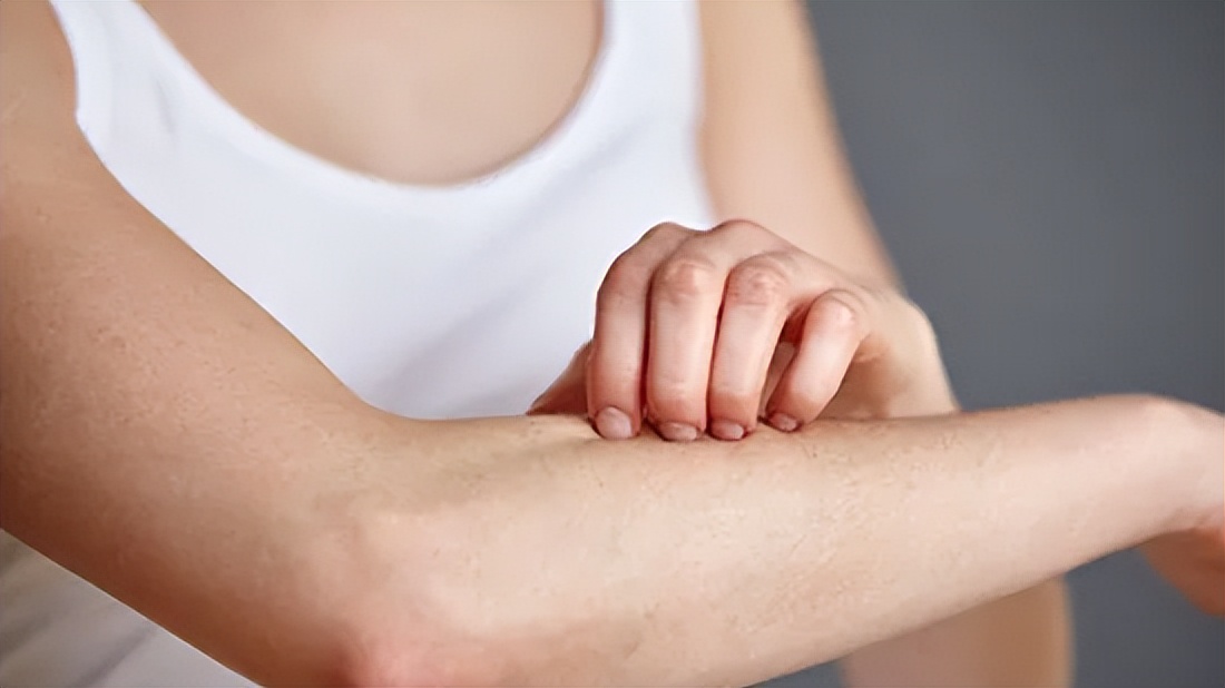 被蚊虫叮咬会痒怎样解决,为什么被蚊虫咬了会痒好几天