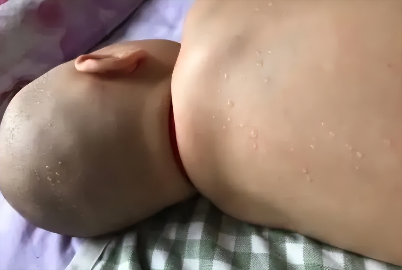 宝宝睡觉时大汗淋漓,宝宝睡着后满头大汗缺钙怎么补