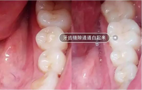 德国sumkyle声波电动牙刷怎么样,声波电动牙刷使用效果如何