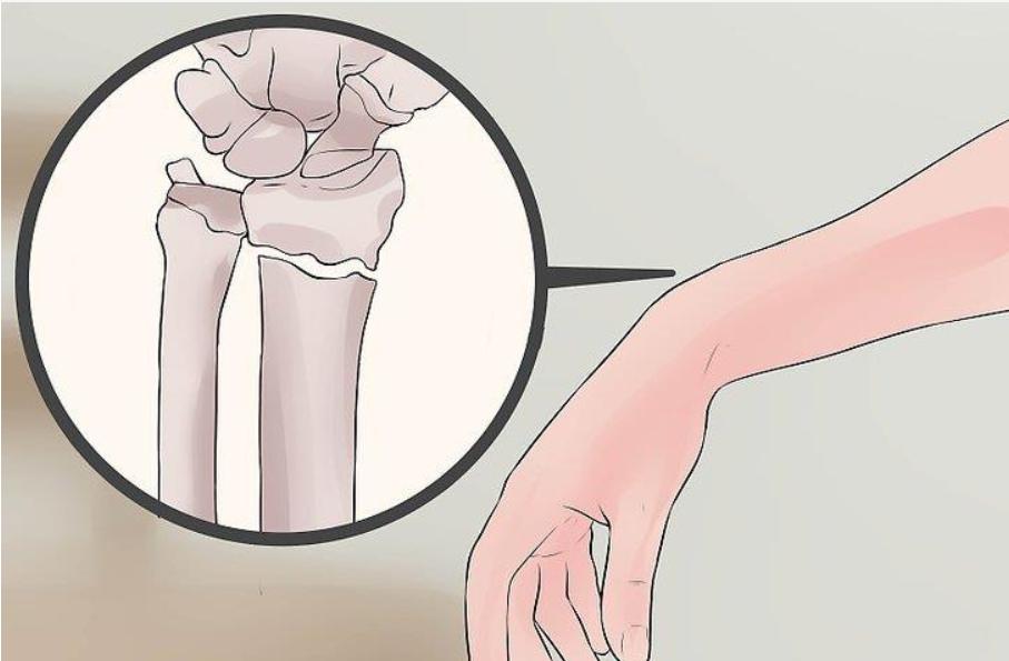 走路时膝盖突然软一下怎么回事,走路时候膝盖突然软一下什么原因