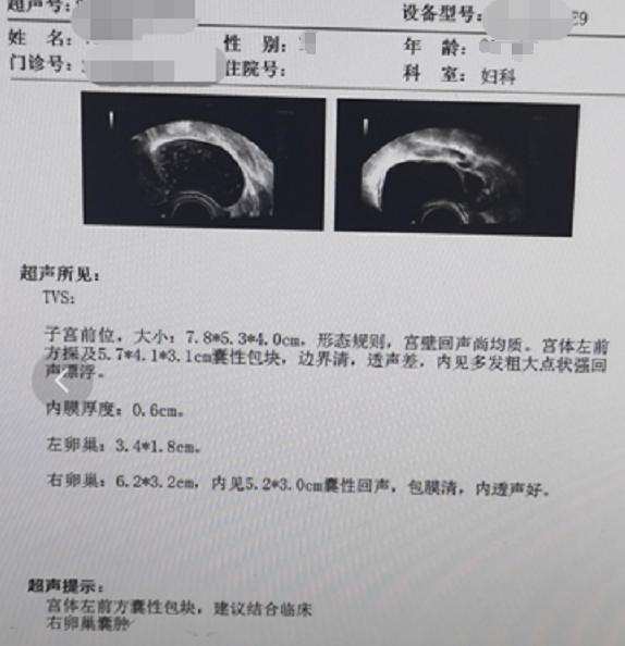 卵巢囊肿一定要重视,卵巢囊肿不要怕