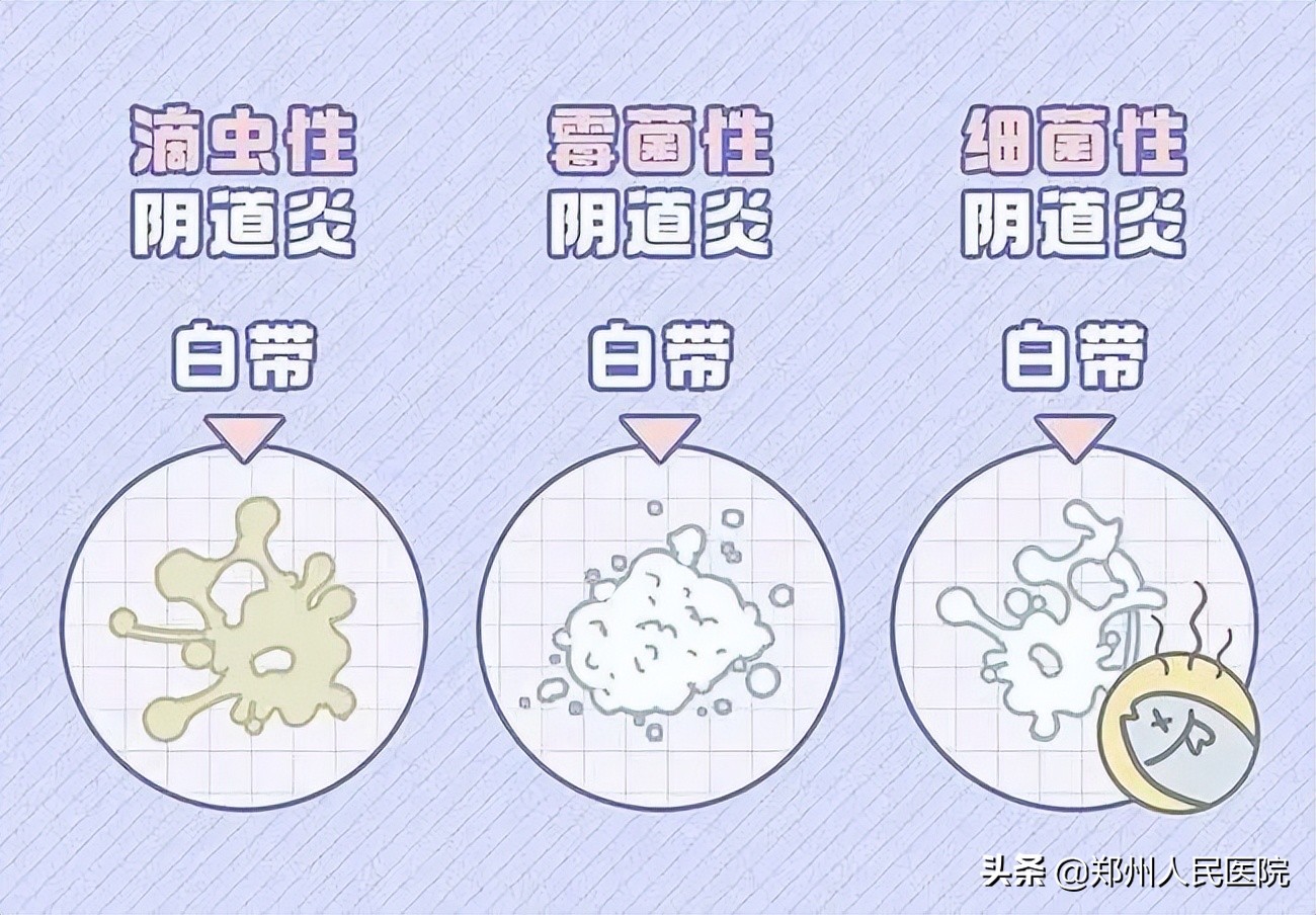 痒到痛不欲生！*处私**的这些尴尬如何解？