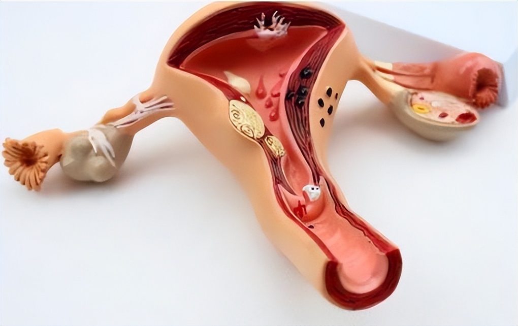 女性摘掉子宫对身体有哪些危害,女性摘掉子宫对女性有什么影响