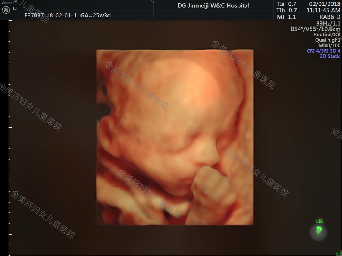 四维彩超宝妈要注意事项,宝妈孕期日记