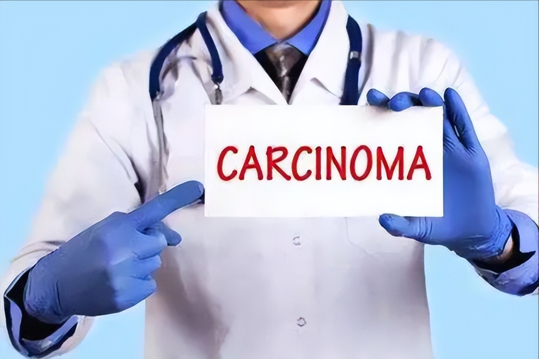 子宫内膜癌有哪些征兆,子宫内膜癌身体没有症状