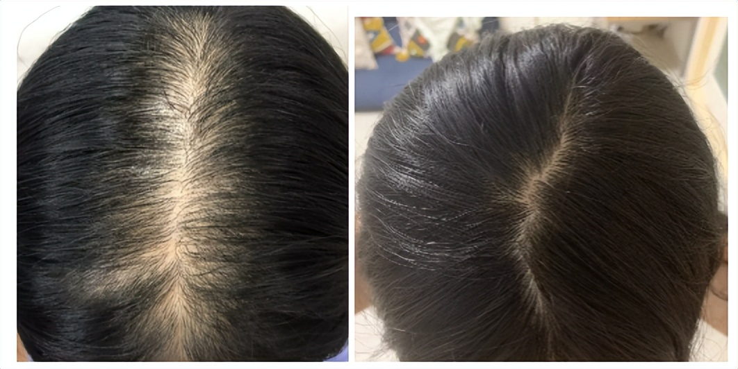 孕妇用的洗发水是智商税吗,孕妇洗发水孕妇专用智商税