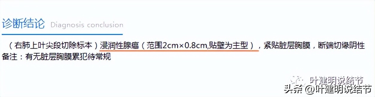 肺癌病理的肿块是硬的吗,肺癌病灶什么样
