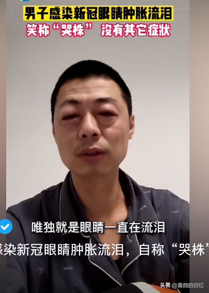 目前的5种毒株,毒株不一样都有哪一种毒株最厉害