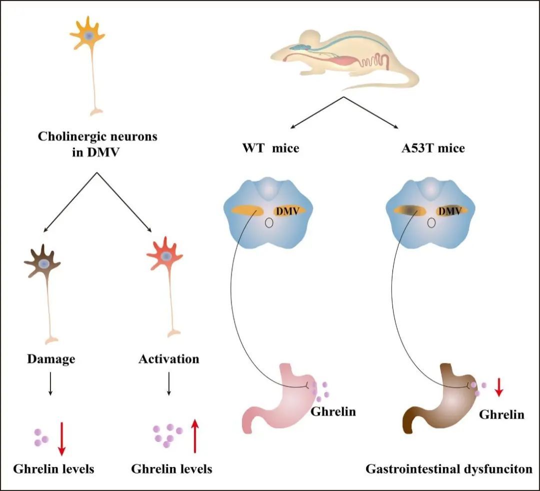 世界帕金森病日第28个主题,世界帕金森病日完整版