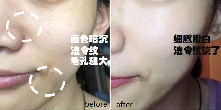 兰蔻极光焕白精华水乳小样,兰蔻极光水乳精华淡斑