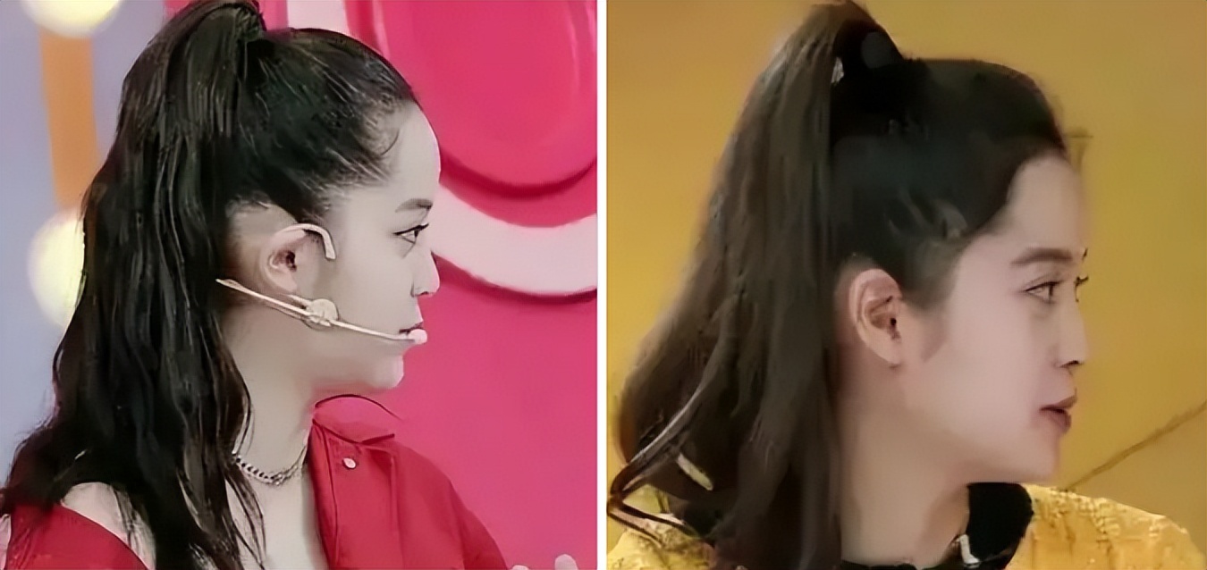 扁平脸影响美感,扁平头会对颜值有影响吗