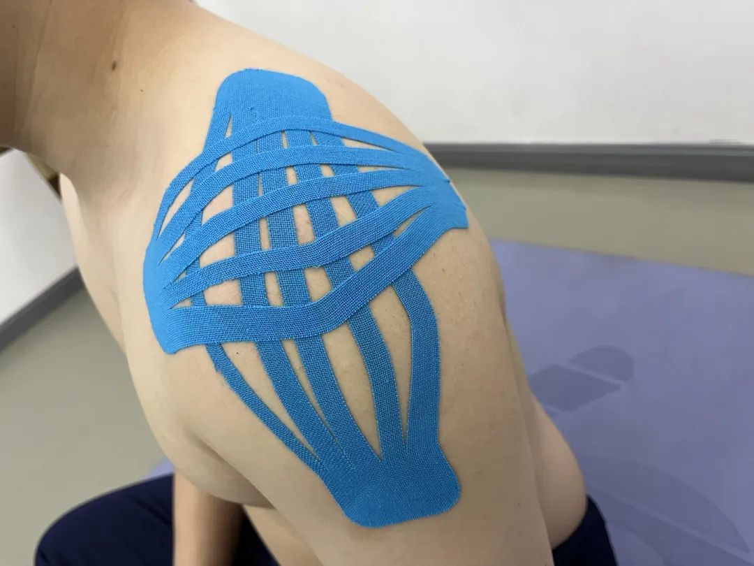 肌效贴颈椎使用方法图解,肩膀疼肌内效贴使用方法