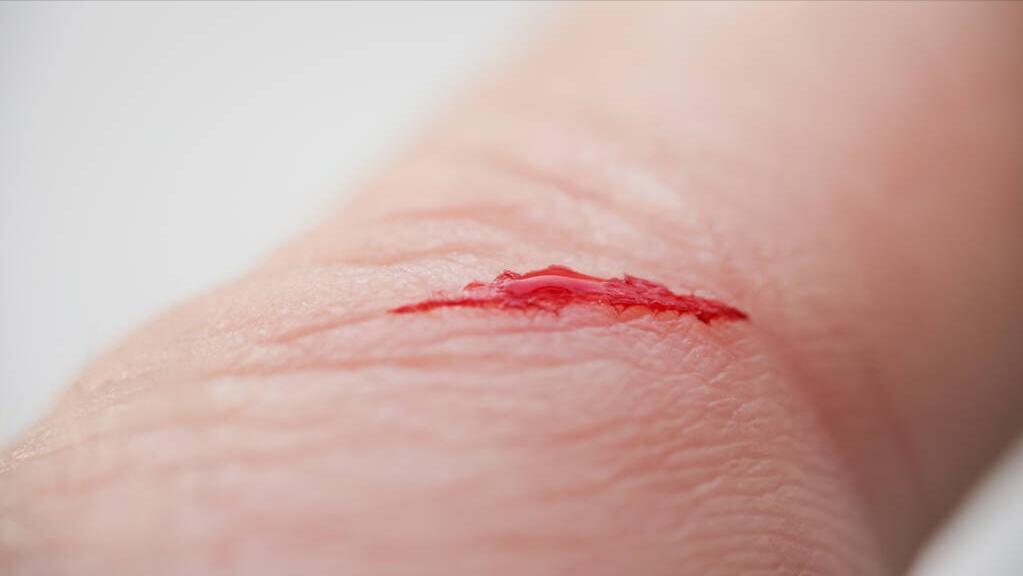 封闭针属不属于兴奋剂,封闭针属于抗生素吗