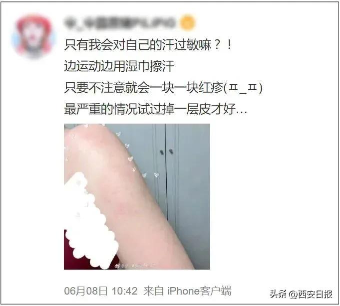 对自己的汗过敏是种怎样的体验,对汗过敏是什么症状