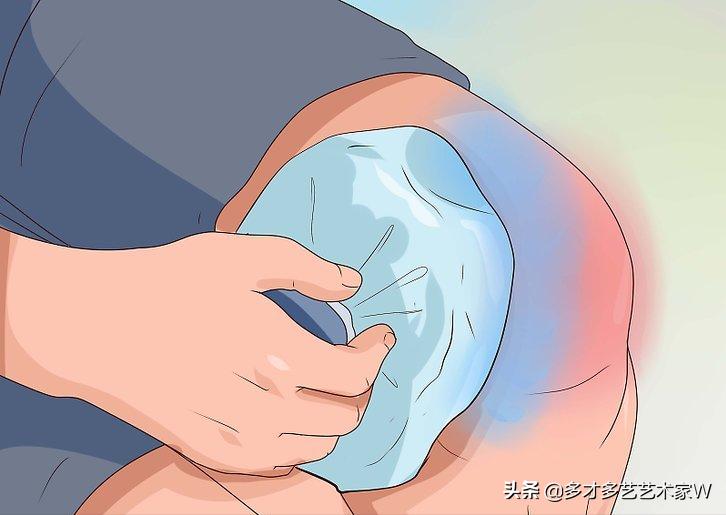 怎么样能缓解膝盖扭伤,膝盖扭伤伸直就疼