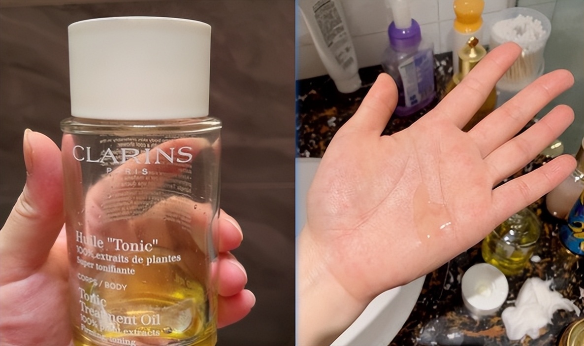 消除妊娠纹是不是智商税,去除肥胖纹妊娠纹产品